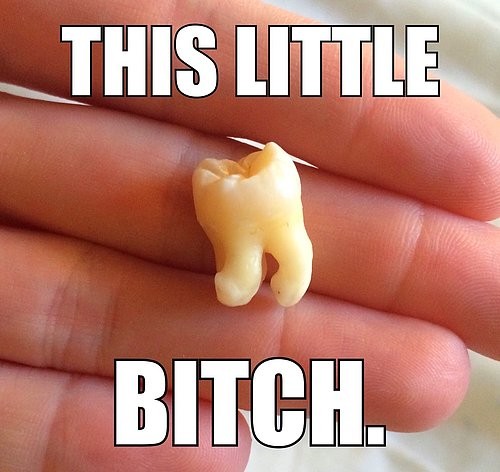 wisdom teeth.jpg