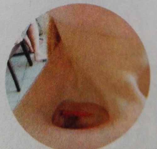 clavícula.jpg