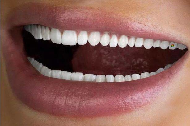 HD Anúncio dentário mostra foto com demasiados d